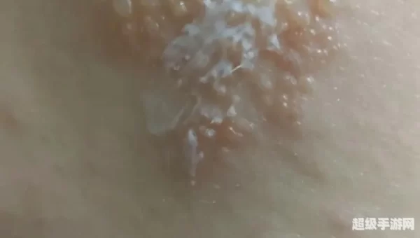 典礼皮缠腰