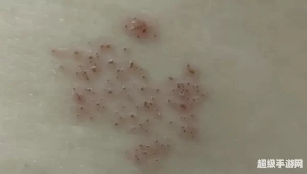 典礼皮缠腰